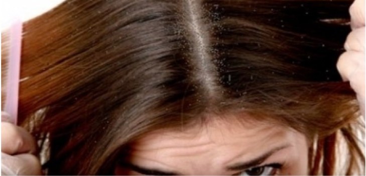 haar met roos