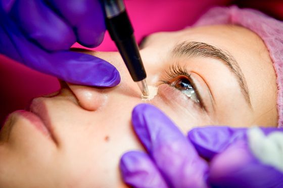 Permanente make-up voor het verbergen van blauwe plekken onder de ogen