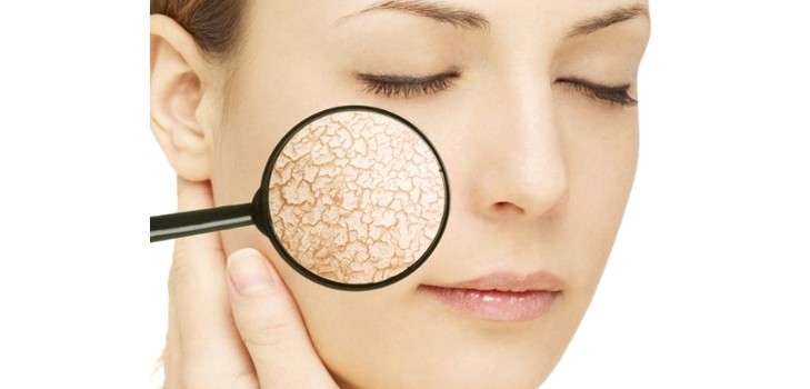 Oliën, maskers en crèmes voor de droge huid