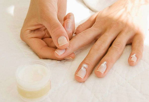 Vijf frequente nagelproblemen: oorzaken en oplossingen