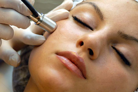  microdermabrasie