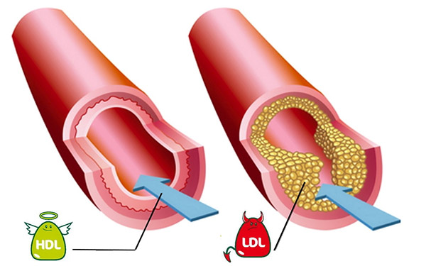 Cholesterol: mythes, waarheid en aanbevelingen van voedingsdeskundigen