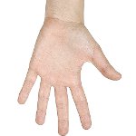 Hoe zich te ontdoen van wratten op uw handen