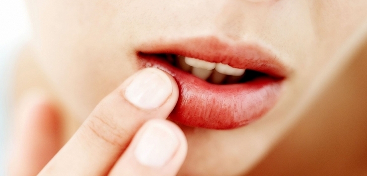 recepten voor de behandeling van verkoudheid op de lippen