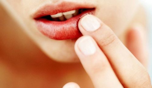  Een snelle en effectieve manier om verkoudheid op de lippen te behandelen: eenvoudige recepten