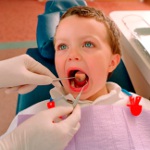 Hoe stomatitis te genezen