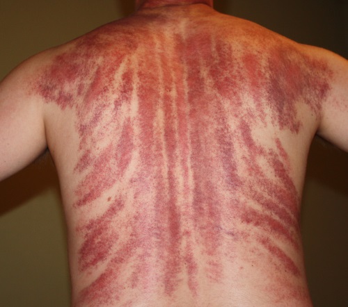 Gouache massagetechniek