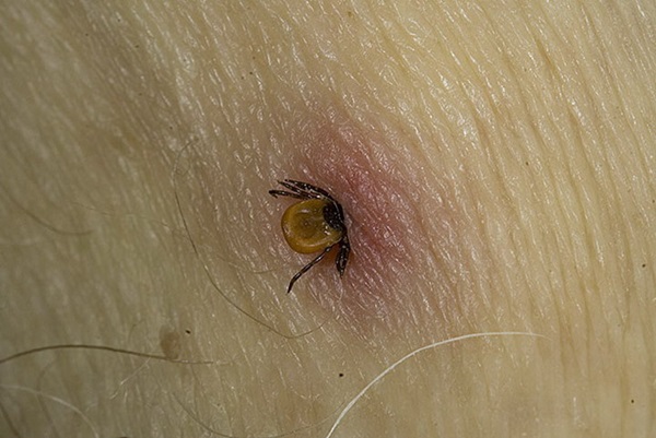 Insectenbeten