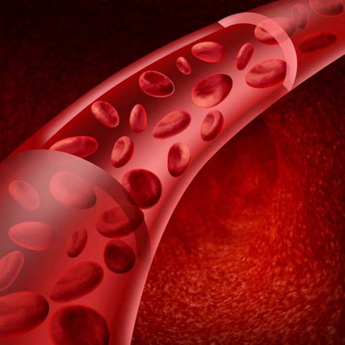 Vasculitis - wat is het? Symptomen, foto's, behandeling